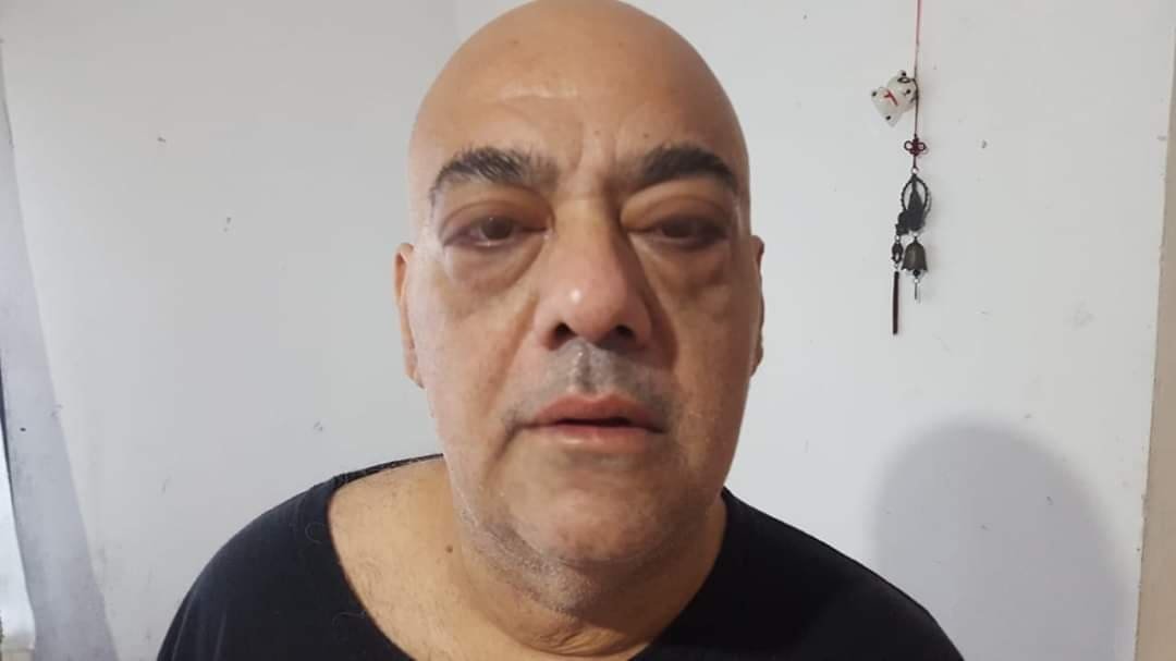 La salud en tiempos de covid-19: paciente busca saber su grado de hipertiroidismo pero no consigue atención