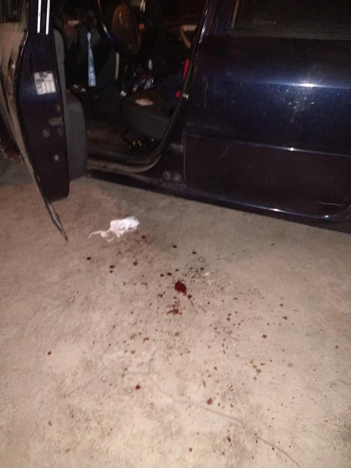 Trabajador de la salud atacado en El Jagüel deberá guardar reposo: “Es lo que lograron, uno menos en la guerra contra el Coronavirus”