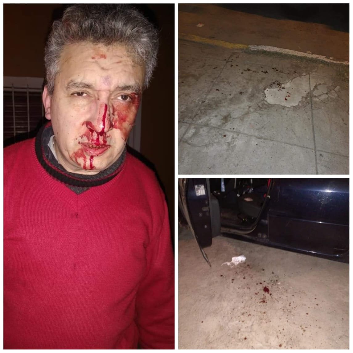 El Jagüel: violenta y salvaje agresión contra un trabajador de la salud