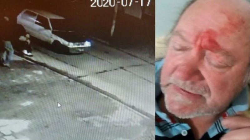 Hallan restos de disparos en la ropa del delincuente que murió baleado por jubilado en Quilmes