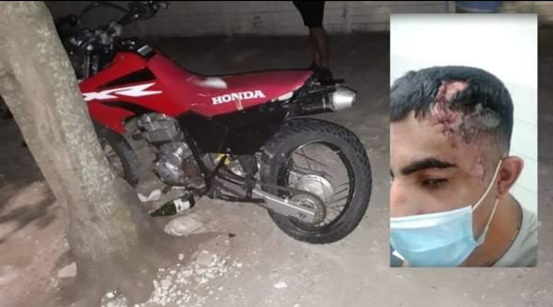 «No somos chorros» dijo el joven atropellado por el marido de Carolina Píparo