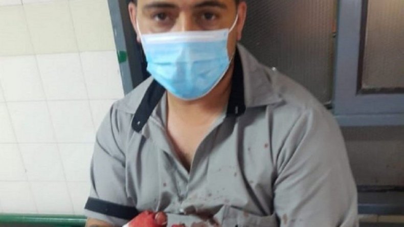 Berazategui: buscan a un hombre que le amputó un dedo a un chofer de colectivo durante un ataque