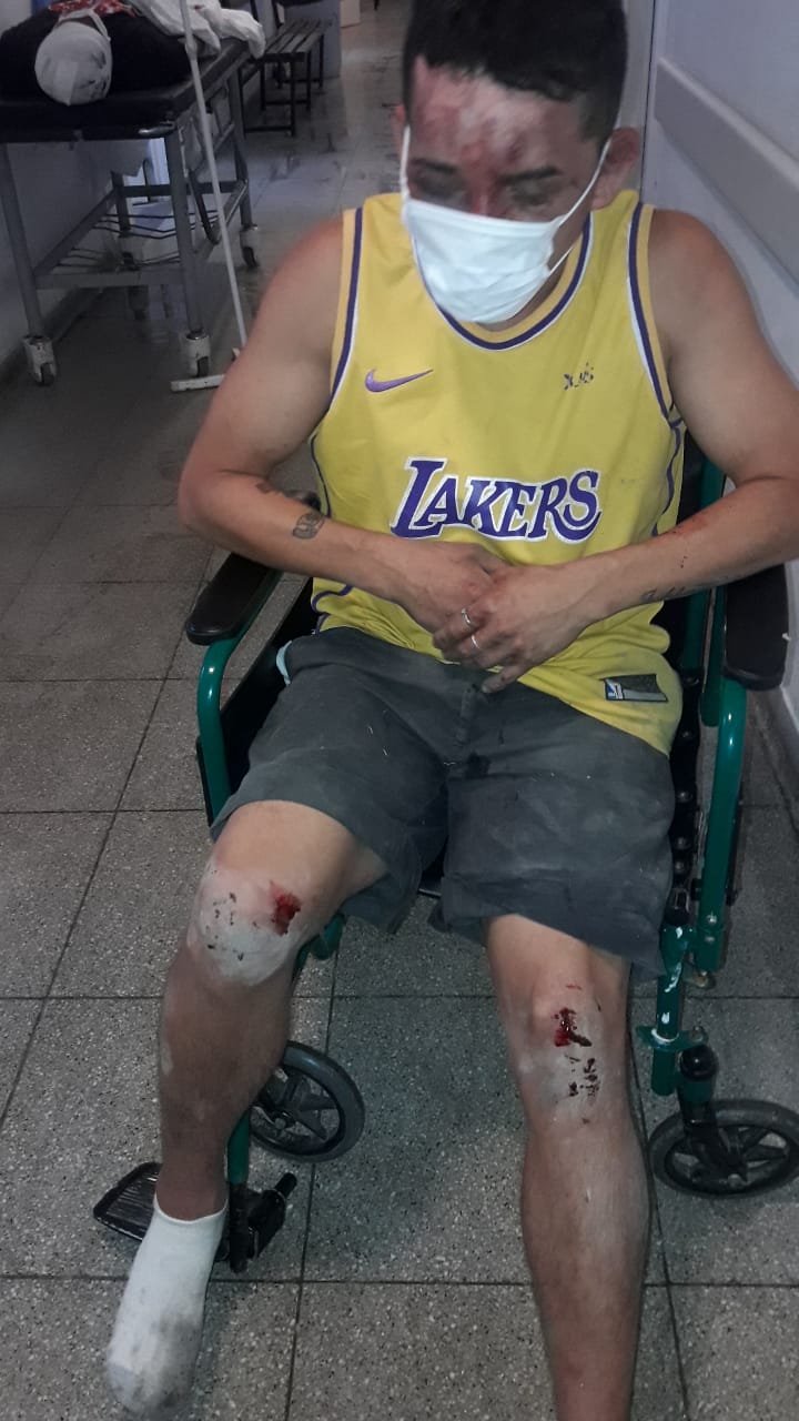 Florencio Varela: un grupo de hombres golpeó y retuvo a un motochorro que quiso asaltar a una mujer