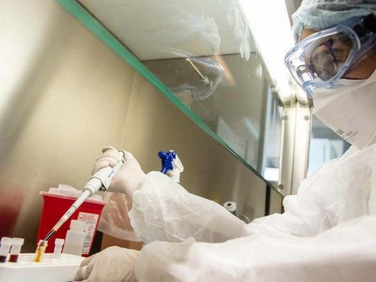 peru-buscan-identificar-si-existe-una-cepa-andina-del-nuevo-coronavirus