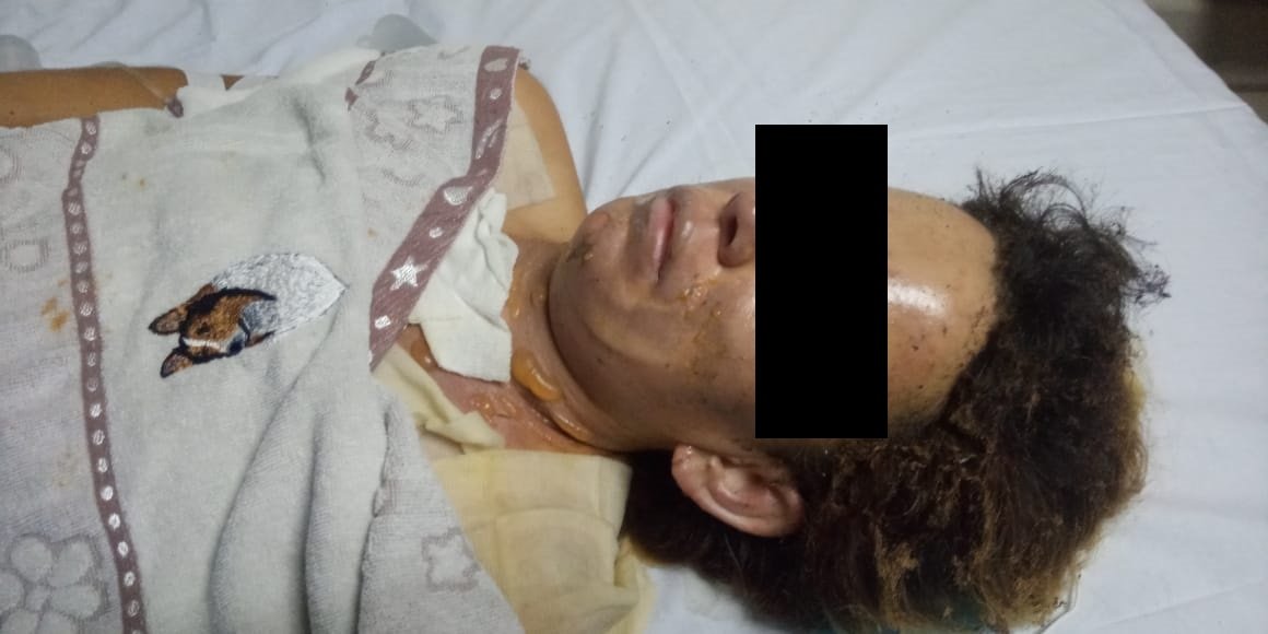 Villa Centenario: se negó a declarar un hombre acusado de quemar a su expareja frente a la hija de ambos