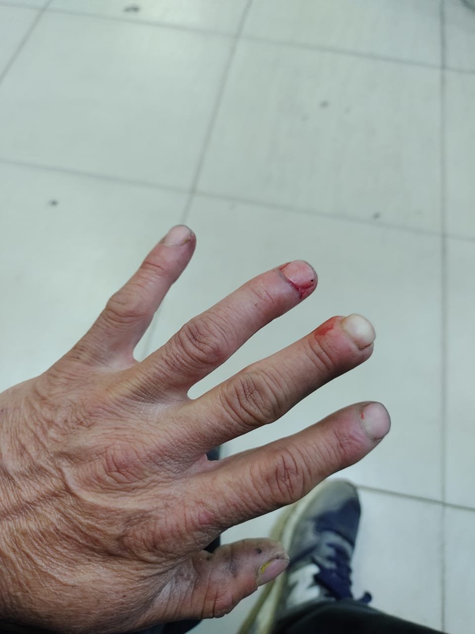 Interna peronista caliente en Esteban Echeverría: un matrimonio agarró a las trompadas a otro también militante de Fernando Gray