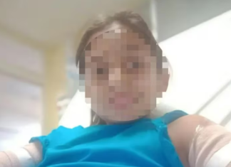 Lomas de Zamora: madre denunció que un niño de 10 años prendió fuego a su hija con alcohol “por celos” del viaje familiar que iban a realizar