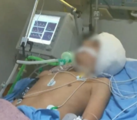 Continúa en terapia: aseguran que se agravó la salud del joven de 13 años atacado a martillazos en la Plaza Grigera de Lomas de Zamora