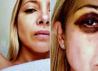 Difundieron fotos de Fabiola Yáñez golpeada y chats reveladores