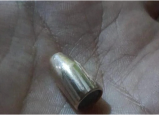 Lomas de Zamora: adolescente herido por bala perdida durante velorio tumbero