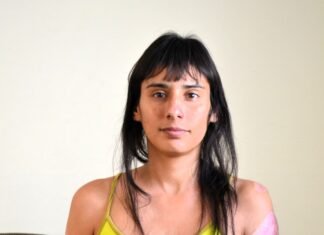 Piden ayuda para una mujer quemada por su ex pareja en Florencio Varela