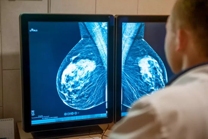 mamografia-telemedicina-morsch