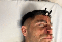 Brutal agresión en un club de Berazategui: le incrustaron una llave de auto en la cabeza mientras veía jugar a su hija