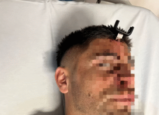 Brutal agresión en un club de Berazategui: le incrustaron una llave de auto en la cabeza mientras veía jugar a su hija